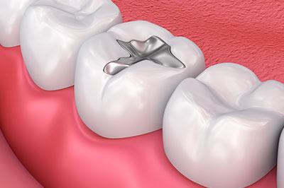 B G Dental | Dentures, Cosmetic Dentistry and Periodontal Treatment