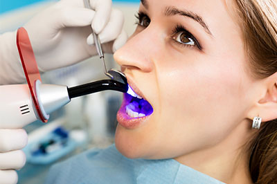 B G Dental | Night Guards, Ceramic Crowns and All-on-6