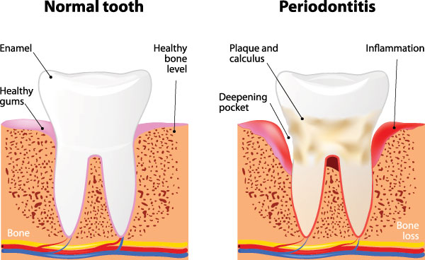 B G Dental | Sleep Apnea, Digital Radiography and Pediatric Dentistry